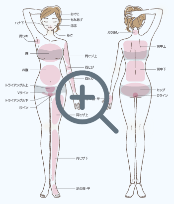 脱毛パーツ表