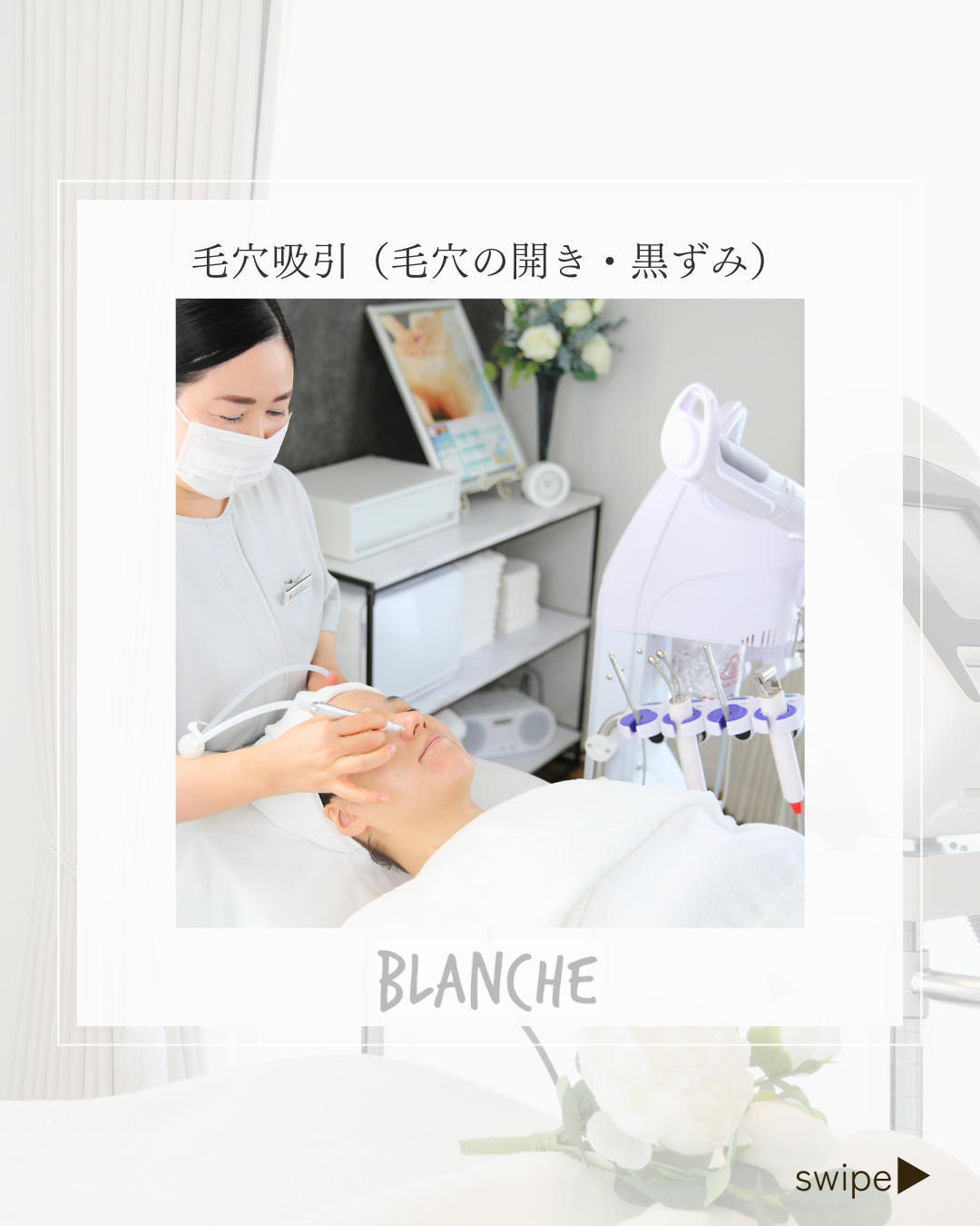 毛穴の開き&小鼻の黒ずみ/毛穴吸引/富士市のエステ